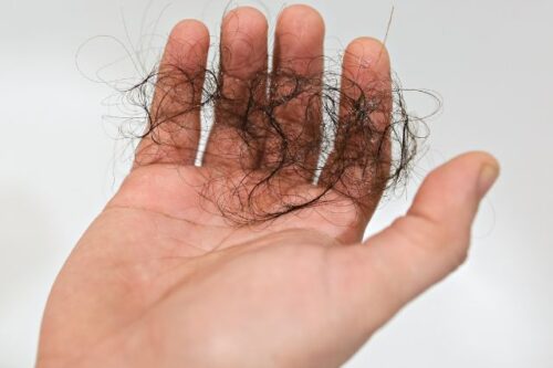 simple-guide-to-treating-hair-loss-after-covid-19